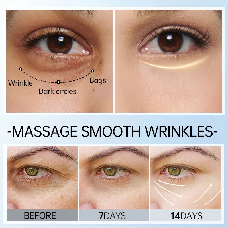 Anti-dark circles and wrinkles